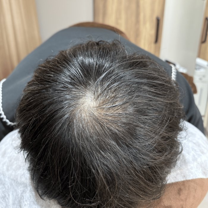 つむじ Before